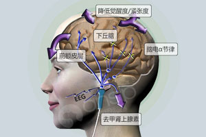 经颅磁治疗仪价格